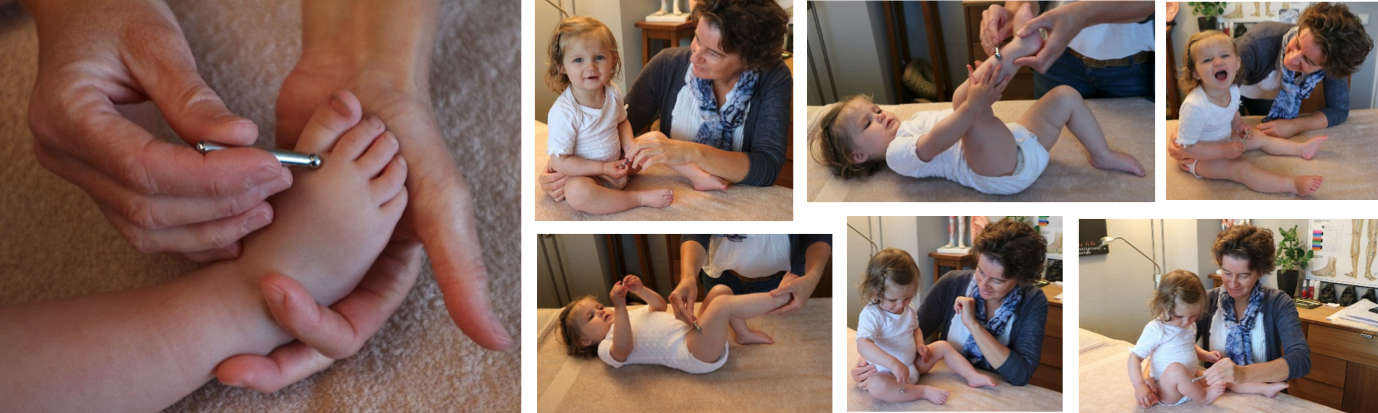 acupunctuur shonishin